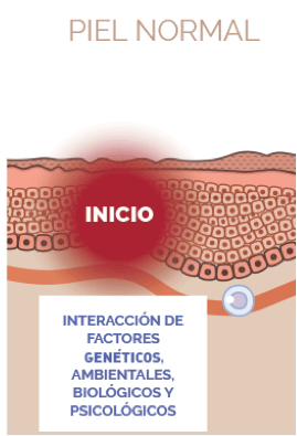 brote de psoriasis