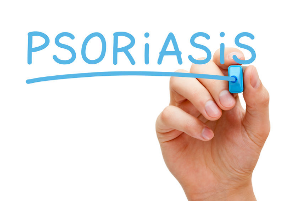 psoriasis que es sntomas y tratamientos psoriasis que es sintomas y tratamientos