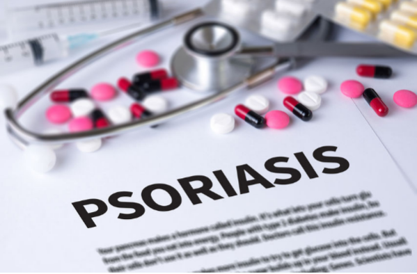 psoriasis consejos