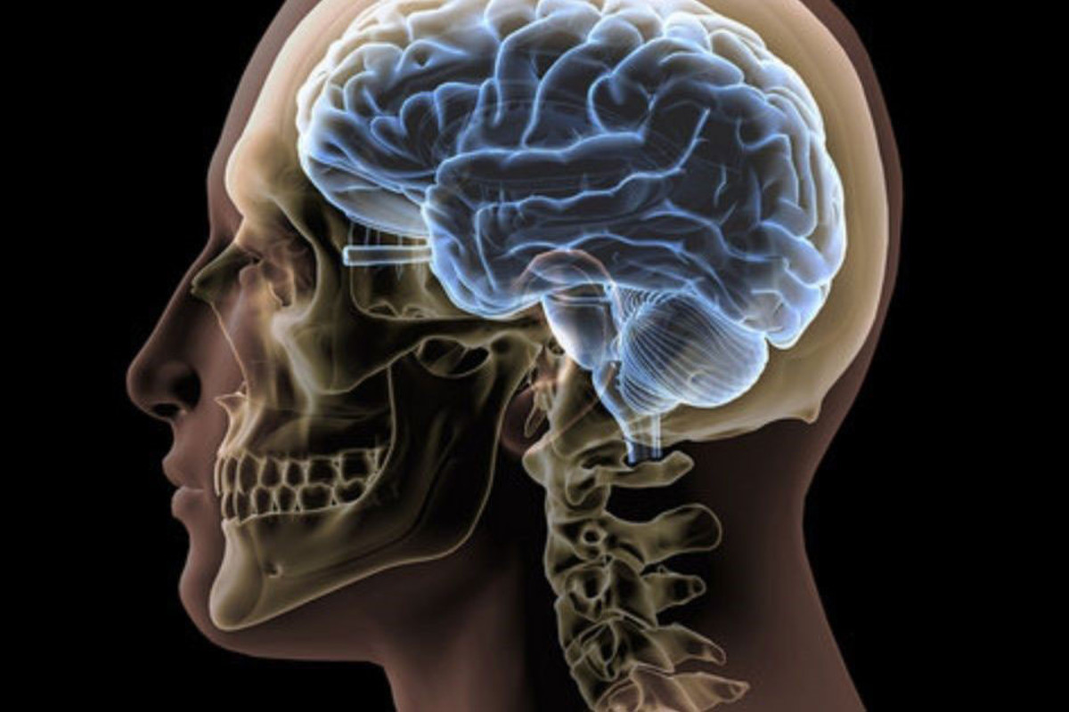 inteligencia artificial facilita la deteccin de aneurismas cerebrales inteligencia artificial facilita la deteccion de aneurismas cerebrales