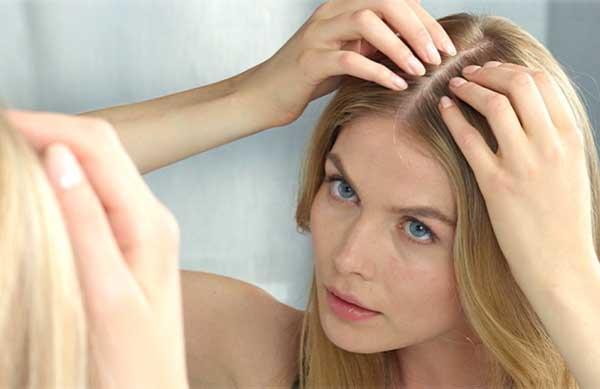 alopecia areata alopecia areata