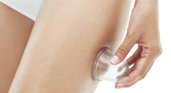 terapia con ventosas terapia con ventosas