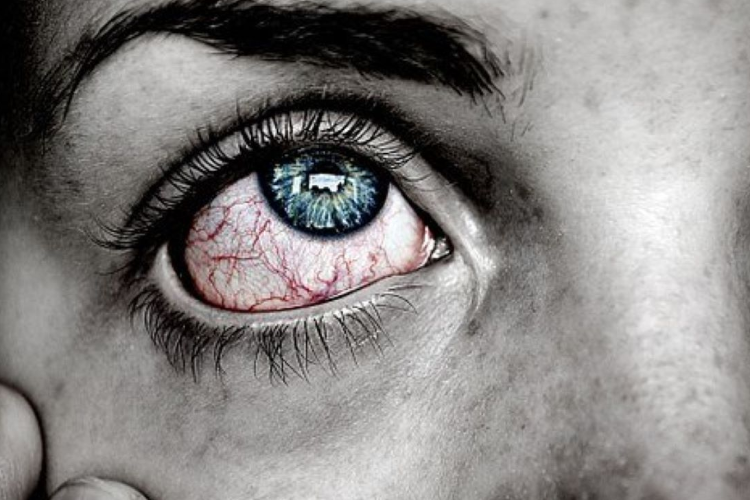 tienes-picor-de-ojos tienes-picor-de-ojos