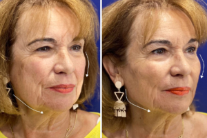 recuperar-el-equilibrio-la-simetria-y-la-belleza-de-un-rostro-joven recuperar-el-equilibrio-la-simetria-y-la-belleza-de-un-rostro-joven
