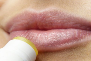 herpes-labial-sintomas-tartamiento-y-prevencion herpes-labial-sintomas-tartamiento-y-prevencion