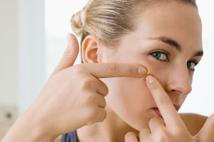 acido-salicilico-una-solucion-para-mantener-a-raya-el-acne-las-e acido-salicilico-una-solucion-para-mantener-a-raya-el-acne-las-e