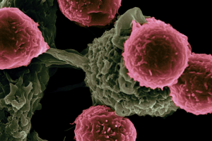 inteligencia-artificial-detecta-50-tipos-de-cancer-a-partir-de-anali inteligencia-artificial-detecta-50-tipos-de-cancer-a-partir-de-anali