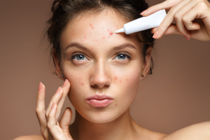 tres-tecnicas-para-ir-despidiendote-del-acne tres-tecnicas-para-ir-despidiendote-del-acne